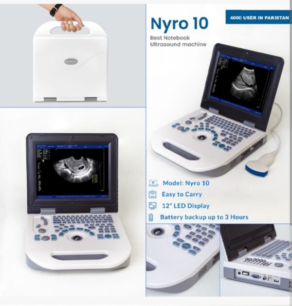 Ultrasound Machine