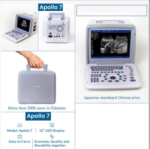 Ultrasound Machine