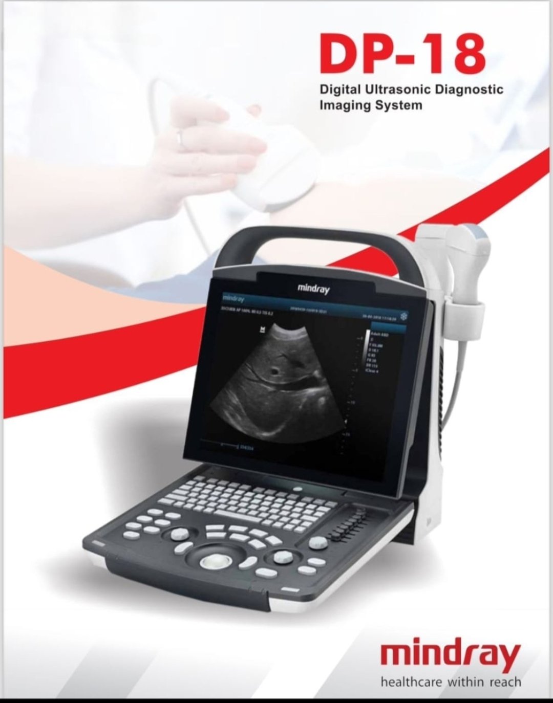 Ultrasound Machine